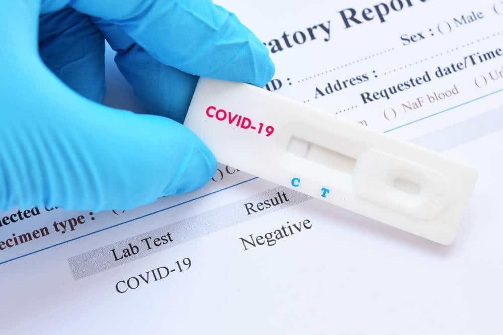 Can I Still Order COVID Test Kits When Free Testing Ends?